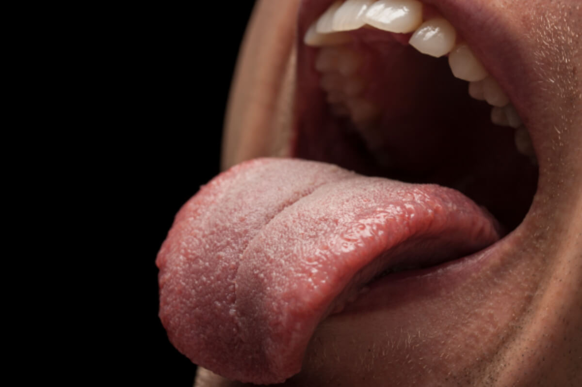 Gag reflex: Suppressing it when blowing